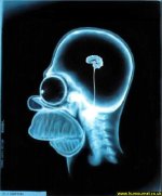 hjsimpsonx-ray.jpg
