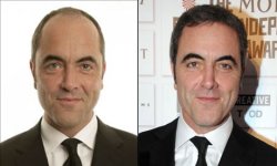 James-Nesbitt-Before-After.jpg