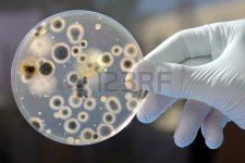 5320347-hand-holds-petri-dish-with-bacteria-culture.jpg