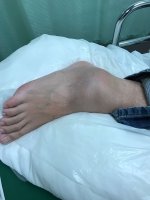 Ankle.jpg